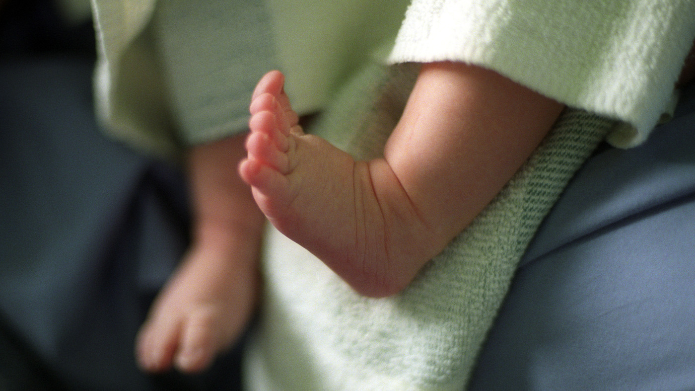 Portuguese Doctor Suspended After Baby Born Without A Face