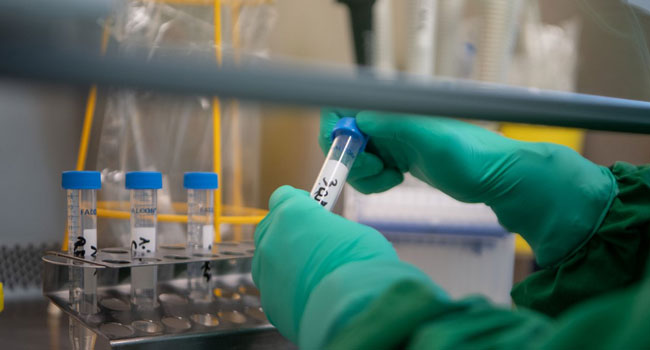 Coronavirus- Facebook, Google Staff To Work From Home