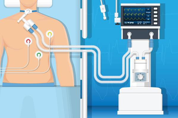 Why Ventilators Are Very Important In The Covid-19 Fight