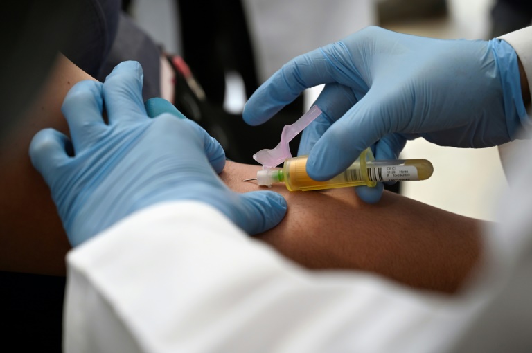 What HIV Can Teach Us About COVID-19