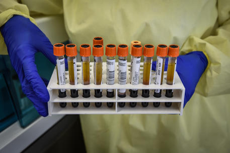 Italian Firm Takis Develops World’s First Virus Vaccine