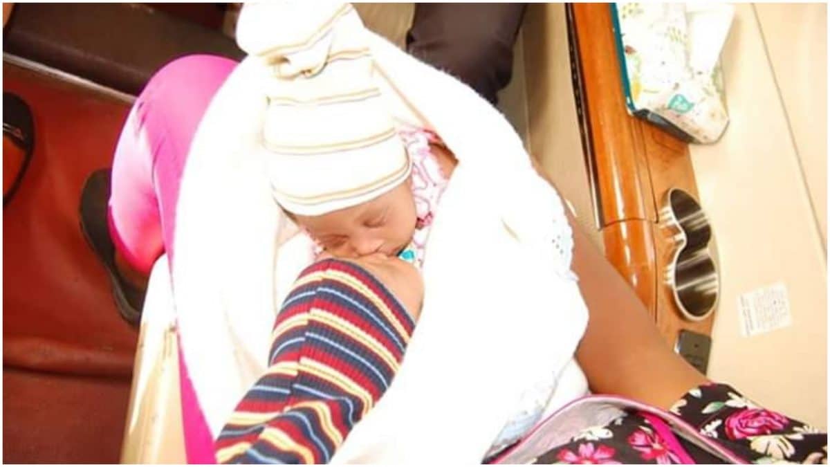 Yola Hospital Separates Twins Joined At Birth