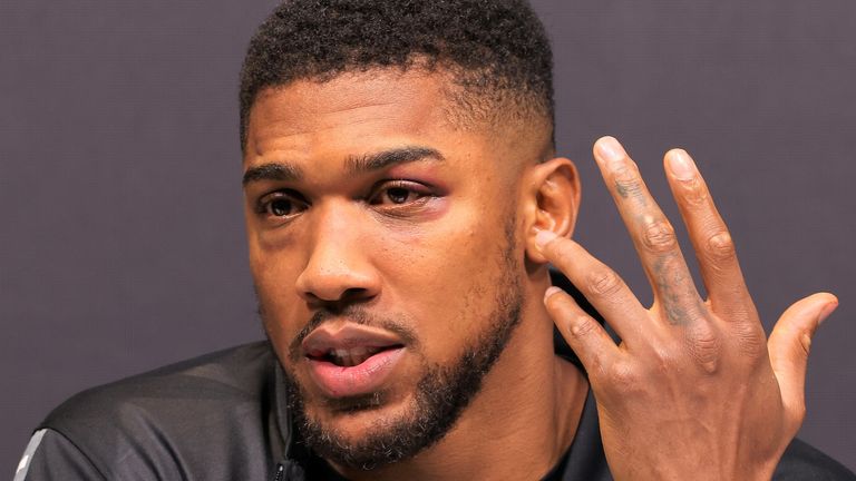 I Will Fight Tyson Fury Without My Belts – Anthony Joshua