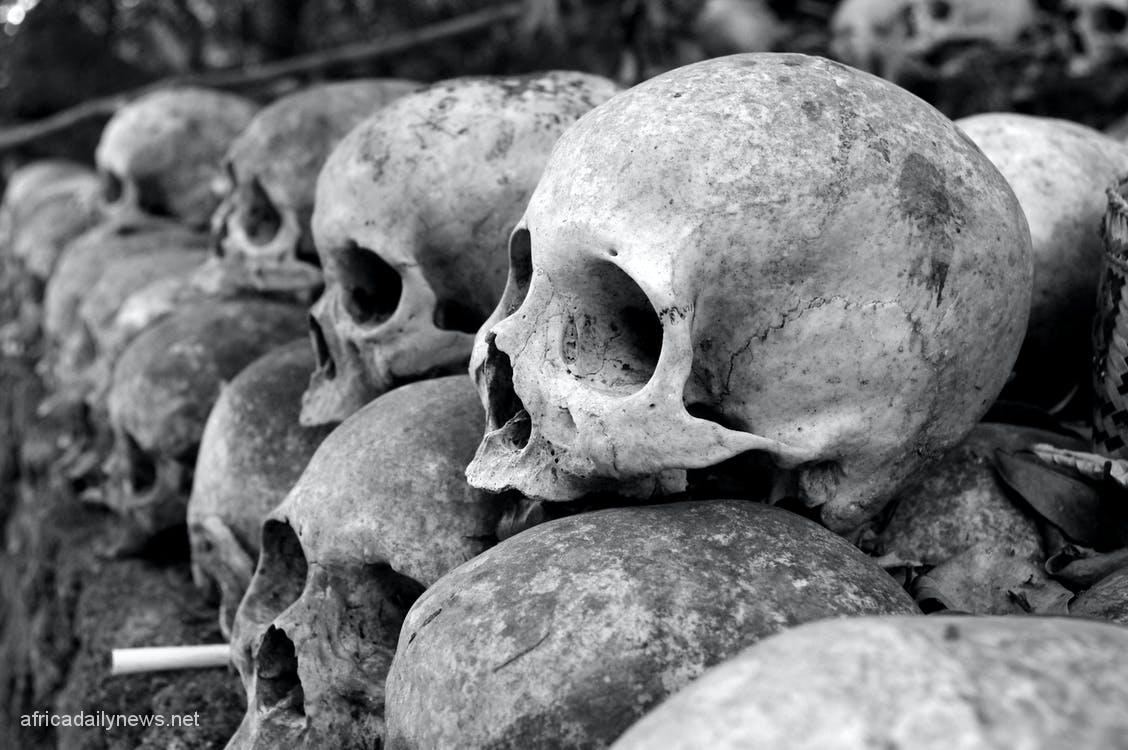 Ukraine Finds Dozens Of Bodies In A Grave Near Kiev