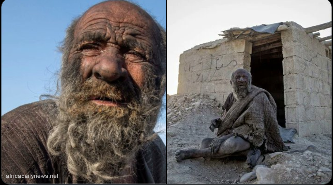 ‘World’s Dirtiest Man’ Passes On Few Months After First Bath